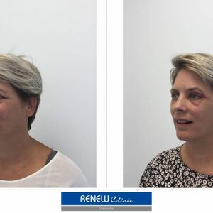 Renew Clinic image 1